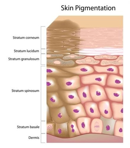 Pigmentation - The Norwich Face & Body Clinic