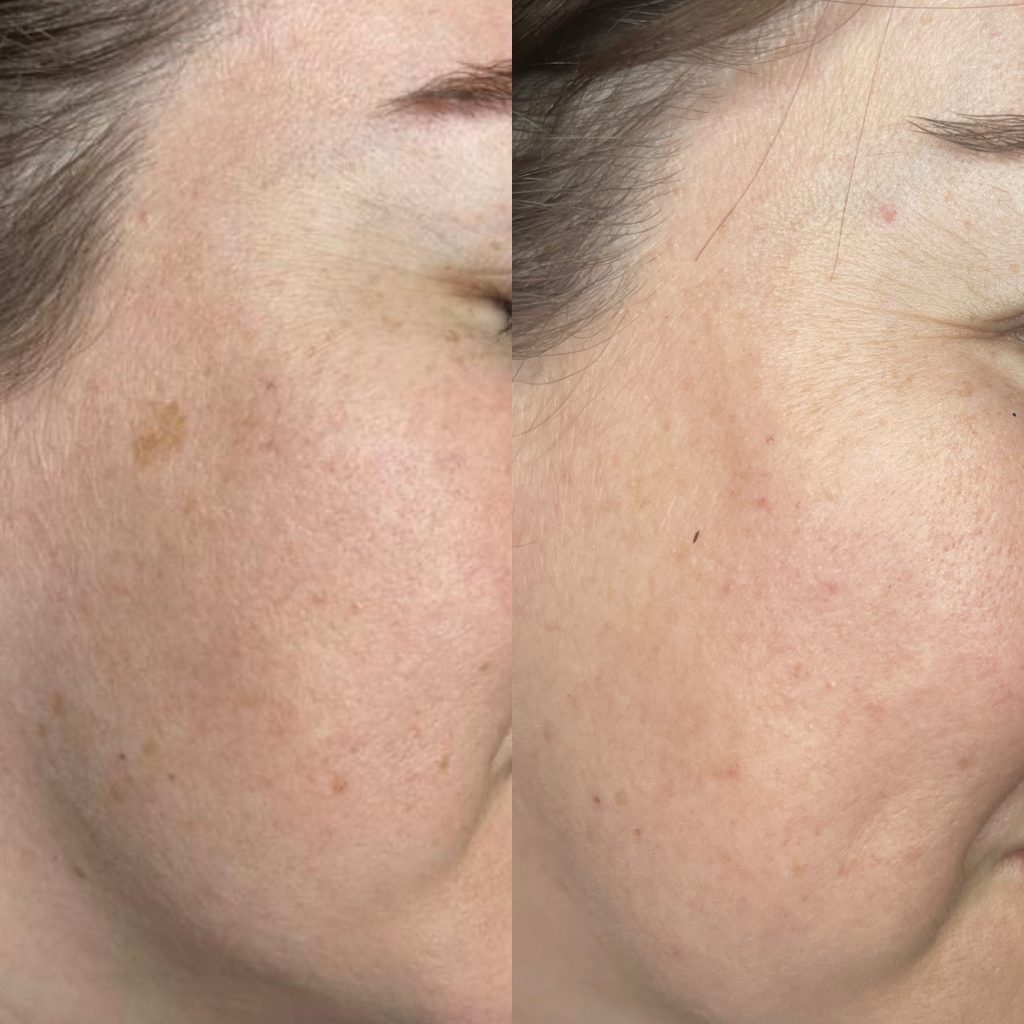 Laser spots sales