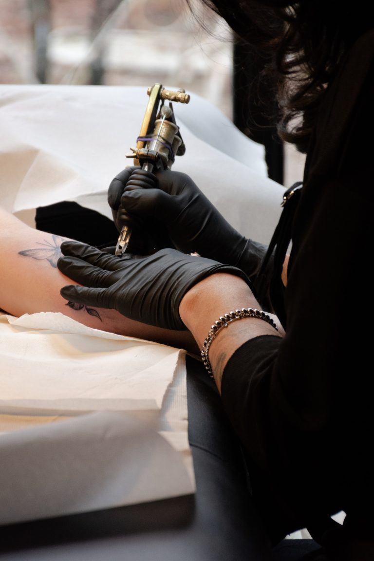 If you've got an unwanted tattoo then laser tattoo removal in Norwich might be for you!